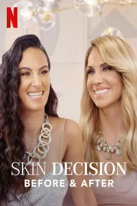 Skin Decision: Before and After posteri