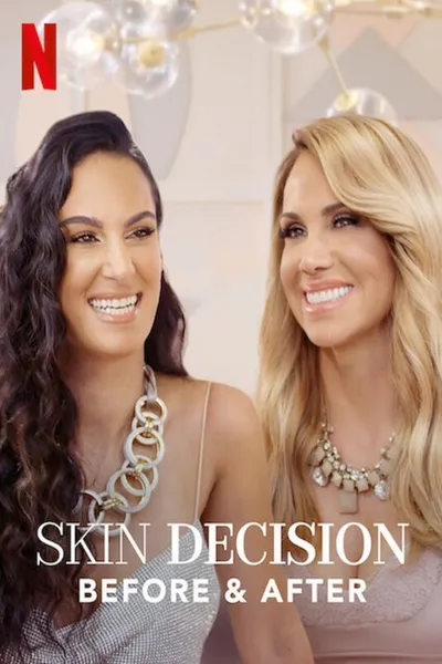 Skin Decision: Before and After posteri